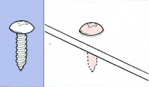 トラスタッピング